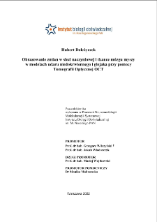 Obrazowanie zmian w sieci naczyniowej i tkance m&oacute;zgu myszy w modelach udaru niedokrwiennego i glekaja przy pomocy Tomografii Optycznej OCT : praca doktorska