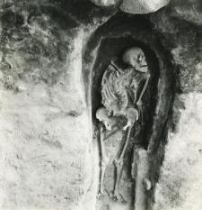 Grave 4-88, burial cut, inhumation - skeleton with birth defect