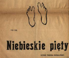 To są niebieskie pięty, kt&oacute;re trzeba pomalować