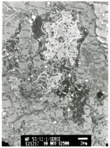 Studies of heart ultrastructure in various diseass by prof A. Fidziańska-Dolot (2004-2013) - 53/12