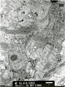 Studies of heart ultrastructure in various diseases by prof A. Fidziańska-Dolot: heart failure - 46/10