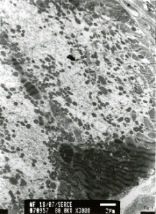 Studies of heart ultrastructure in various diseass by prof A. Fidziańska-Dolot (2004-2013) - 18/07