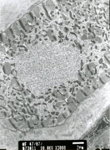 Studies of heart ultrastructure in various diseass by prof A. Fidziańska-Dolot (2004-2013) - 47/07