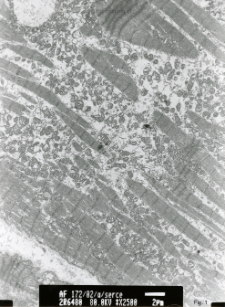 Studies of heart ultrastructure in various diseass by prof A. Fidziańska-Dolot (2004-2013) - 172/02
