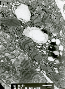 Studies of heart ultrastructure in various diseass by prof A. Fidziańska-Dolot (2004-2013) - 48/09