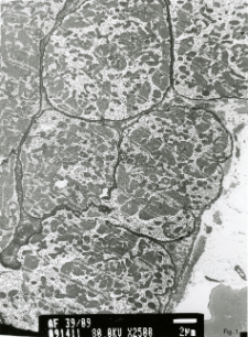 Studies of heart ultrastructure in various diseass by prof A. Fidziańska-Dolot (2004-2013) - 39/09
