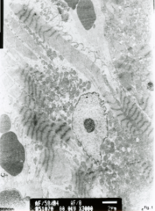 Studies of heart ultrastructure in various diseass by prof A. Fidziańska-Dolot (2004-2013) - 58/04
