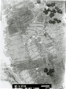Studies of heart ultrastructure in various diseass by prof A. Fidziańska-Dolot (2004-2013) - 4/05