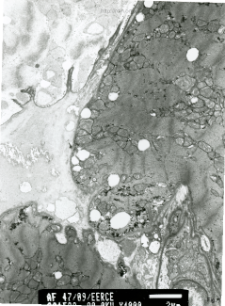 Studies of heart ultrastructure in various diseass by prof A. Fidziańska-Dolot (2004-2013) - 47/09