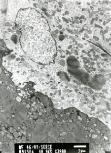 Studies of heart ultrastructure in various diseass by prof A. Fidziańska-Dolot (2004-2013) - 46/09