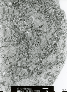 Studies of heart ultrastructure in various diseass by prof A. Fidziańska-Dolot (2004-2013) - 42/04