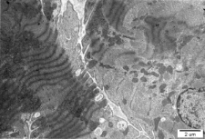 Studies of heart ultrastructure in various diseass by dr Michal Walski - 43/2000