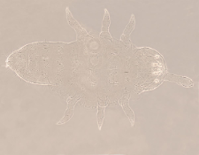 Protaphorura sp.