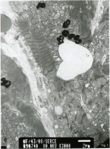 Studies of heart ultrastructure in various diseases by prof A. Fidziańska-Dolot: heart failure - 43/08