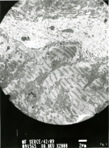 Studies of heart ultrastructure in various diseases by prof A. Fidziańska-Dolot: heart failure - 42/09