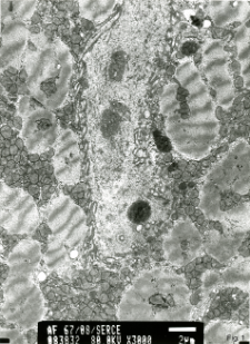 Studies of heart ultrastructure in various diseass by prof A. Fidziańska-Dolot (2004-2013)