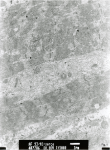 Studies of heart ultrastructure in various diseass by prof A. Fidziańska-Dolot (2004-2013) - 93/02
