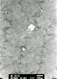 Studies of heart ultrastructure in various diseass by prof A. Fidziańska-Dolot (2004-2013) - 55/07